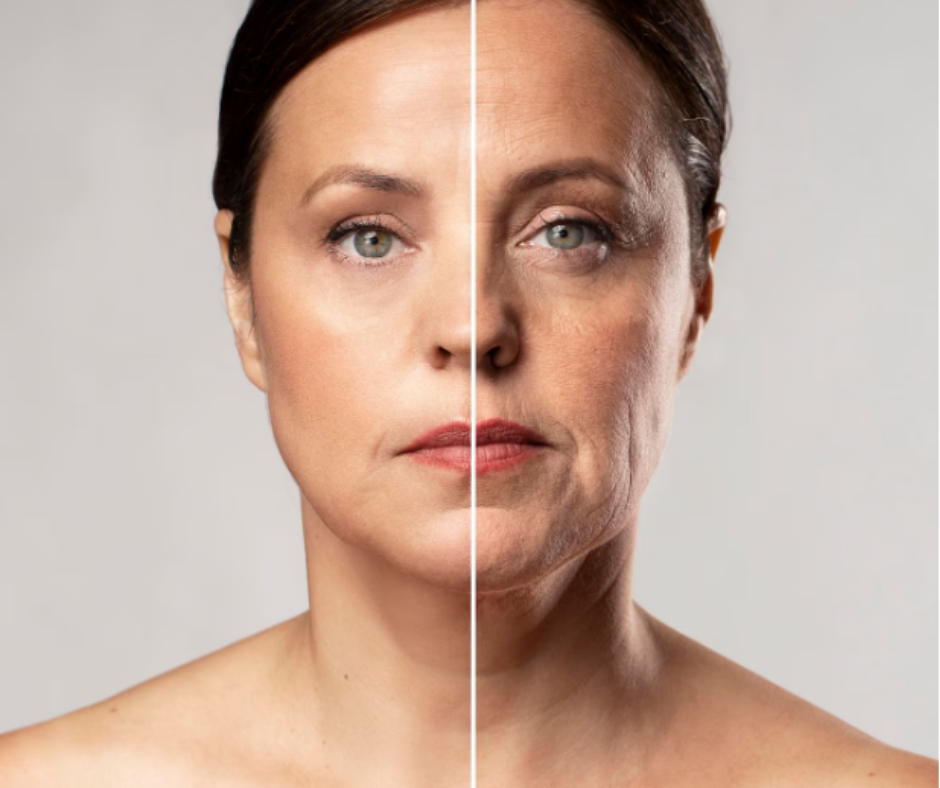 What I Learned About Botox